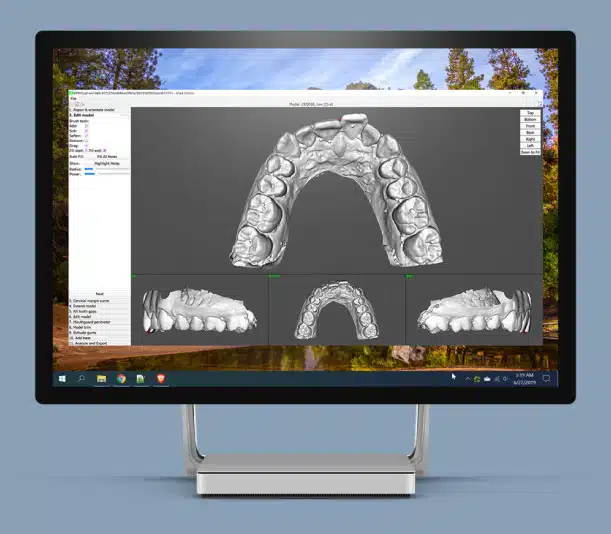 Mouthguard Portfolio Image